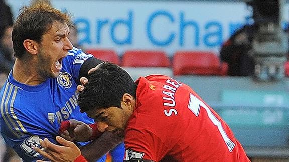 Saurez Biting Incident